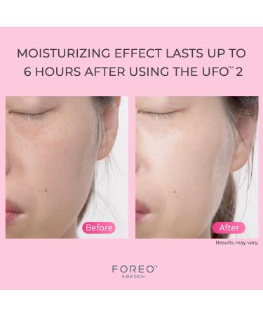 Discover FOREO UFO 2 Swedish Beauty-Tech Power Mask - Elevate Your Style Instantly! - Buy Online on GoSupps.com