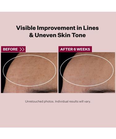 StriVectin Advanced Retinol Nightly Multi-Correct Serum 1.0 oz - Transform Your Style with the Best Innovation Today! - Buy Online on GoSupps.com