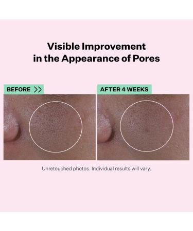 Discover StriVectin Multi-Action Super Shrink Pore Minimizing Serum 1.0 oz - Elevate Your Style Instantly! - Buy Online on GoSupps.com