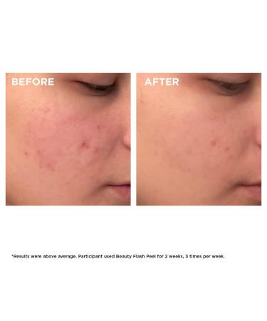 Discover Clarins Beauty Flash Peel with BHA & AHA 1.7 oz - Elevate Your Style Instantly! - Buy Online on GoSupps.com