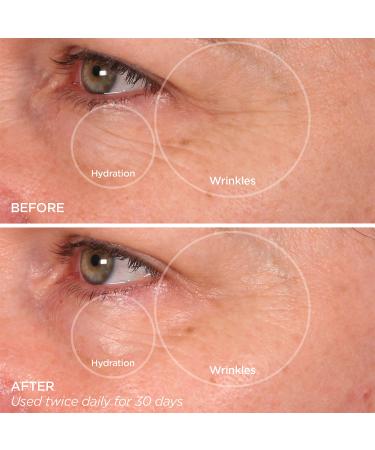 BeautyBio The Quench Eye Pro-Strength Brightening Balm 0.5 oz - Transform Your Style with the Best Innovation Today! - Buy Online on GoSupps.com