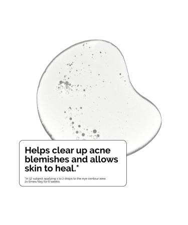 Discover The Ordinary Salicylic Acid 2% Acne Serum 1.0 oz - Elevate Your Style Instantly! - Buy Online on GoSupps.com