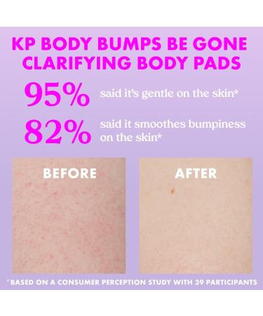 Kopari Beauty KP Body Bumps Be Gone Clarifying Body Pads 50 ct - Discover Premium Quality Shop now! - Buy Online on GoSupps.com