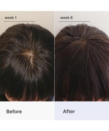 Discover Better Not Younger Superpower+ Advanced Hair Densifying Scalp Serum 2.0 oz - Elevate Your Style Instantly! - Buy Online on GoSupps.com