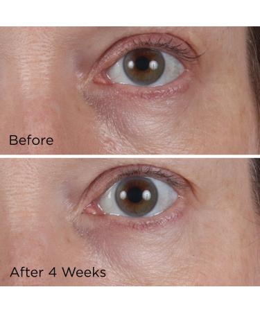 Perricone MD Vitamin C Ester CCC+ Ferulic Brightening Under-Eye Cream 0.5 oz - Discover Premium Quality Shop now! - Buy Online on GoSupps.com