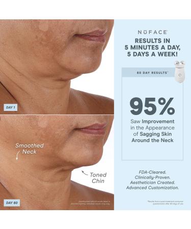 Discover NuFACE TRINITY+ Advanced Microcurrent Kit + Wrinkle Reducer Attachment - Elevate Your Style Instantly! - Buy Online on GoSupps.com