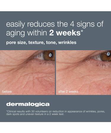 Discover Dermalogica Dynamic Skin Retinol Serum 1.0 oz - Elevate Your Style Instantly! - Buy Online on GoSupps.com