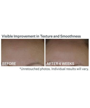 Discover StriVectin Anti-Wrinkle Peptide Plump Line Filling Bounce Serum 1.0 oz - Elevate Your Style Instantly! - Buy Online on GoSupps.com