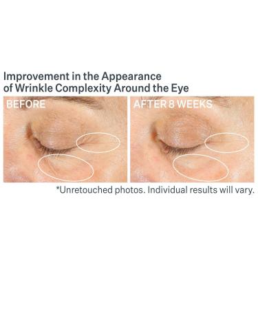 Discover StriVectin Advanced Retinol Multi-Correct Eye Cream 0.5 oz - Elevate Your Style Instantly! - Buy Online on GoSupps.com