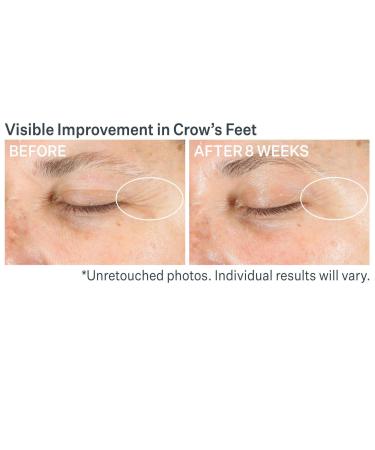 Discover StriVectin Advanced Retinol Multi-Correct Eye Cream 0.5 oz - Elevate Your Style Instantly! - Buy Online on GoSupps.com