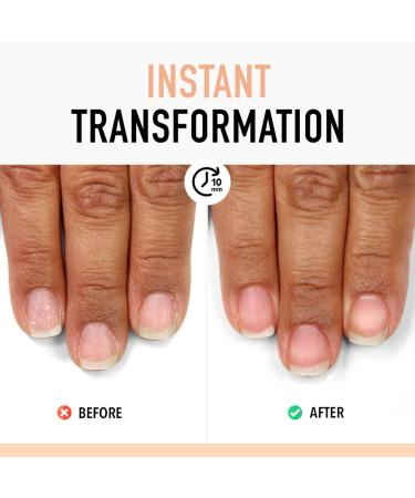 Discover Londontown Nail Probiotic Instant Boost 0.4 oz - Elevate Your Style Instantly! - Buy Online on GoSupps.com