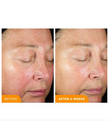 BeautyStat Cosmetics Universal C Skin Refiner 20% Vitamin C Serum + SPF 50 Mineral Sunscreen 1.0 oz - Discover Premium Quality Shop now! - Buy Online on GoSupps.com