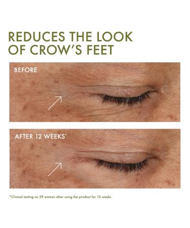 Origins Plantscription Wrinkle Correction Eye Cream with Encapsulated Retinol 0.5 oz - Transform Your Style with the Best Innovation Today! - Buy Online on GoSupps.com