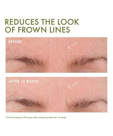 Origins Plantscription Wrinkle Correction Eye Cream with Encapsulated Retinol 0.5 oz - Transform Your Style with the Best Innovation Today! - Buy Online on GoSupps.com