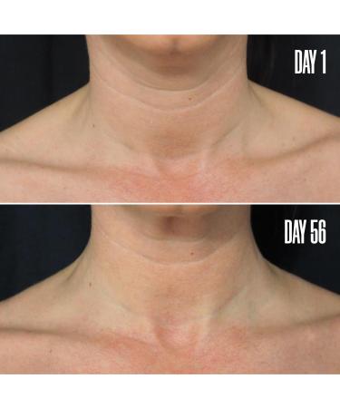 Discover MAÃ‹LYS B-POISED Neck & DÃ©colletÃ© Firming Cream 1.7 oz - Elevate Your Style Instantly! - Buy Online on GoSupps.com