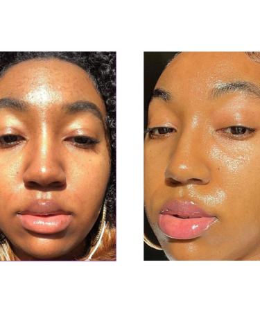 Discover ROSEN Earth Cleanser for Active Breakouts 4.3 oz - Elevate Your Style Instantly! - Buy Online on GoSupps.com