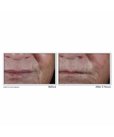 RoC Retinol Correxion Deep Wrinkle Targeted Patches 6 ct - Transform Your Style with the Best Innovation Today! - Buy Online on GoSupps.com