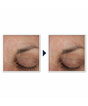 RoC Retinol Correxion Deep Wrinkle Targeted Patches 6 ct - Transform Your Style with the Best Innovation Today! - Buy Online on GoSupps.com