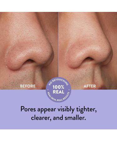 Discover Peach Slices Nose Pore Patches 7 ct - Elevate Your Style Instantly! - Buy Online on GoSupps.com