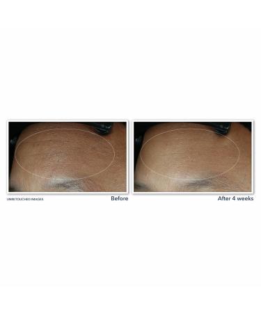 Discover RoC Retinol Correxion Line Smoothing Max Hydration Cream 1.7 oz - Elevate Your Style Instantly! - Buy Online on GoSupps.com