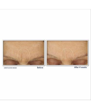 Discover RoC Retinol Correxion Line Smoothing Max Hydration Cream 1.7 oz - Elevate Your Style Instantly! - Buy Online on GoSupps.com