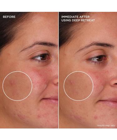 Discover Benefit Cosmetics The POREfessional Deep Retreat Pore-Clearing Clay Mask Mini 1.0 oz - Elevate Your Style Instantly! - Buy Online on GoSupps.com