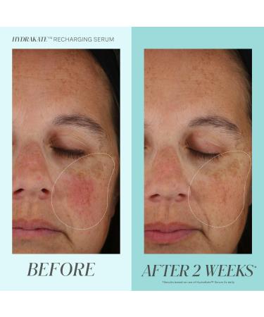 Kate Somerville HydraKate Recharging Serum with Hyaluronic Acid 1.0 oz - Transform Your Style with the Best Innovation Today! - Buy Online on GoSupps.com