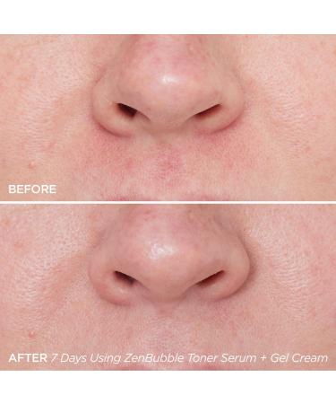 BeautyBio ZenBubble Bi-Phase Toner Serum 1.7 oz - Transform Your Style with the Best Innovation Today! - Buy Online on GoSupps.com