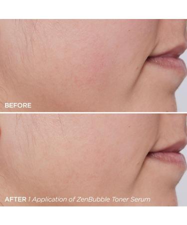 BeautyBio ZenBubble Bi-Phase Toner Serum 1.7 oz - Transform Your Style with the Best Innovation Today! - Buy Online on GoSupps.com