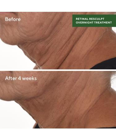 Discover Murad Retinal ReSculpt Overnight Treatment 1.0 oz - Elevate Your Style Instantly! - Buy Online on GoSupps.com