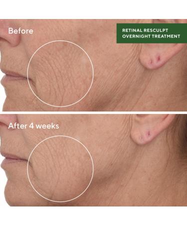 Discover Murad Retinal ReSculpt Overnight Treatment 1.0 oz - Elevate Your Style Instantly! - Buy Online on GoSupps.com