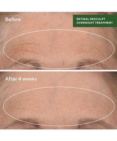 Discover Murad Retinal ReSculpt Overnight Treatment 1.0 oz - Elevate Your Style Instantly! - Buy Online on GoSupps.com