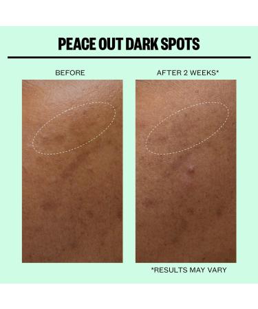 Peace Out Dark Spots Microneedling Brightening Dots 12 ct - Transform Your Style with the Best Innovation Today! - Buy Online on GoSupps.com