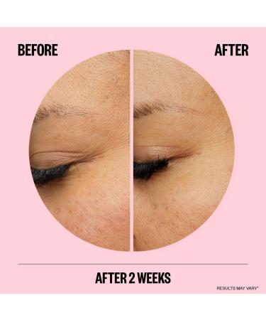 Discover Peace Out Microneedling Anti-Wrinkle Retinol Patches 6 ct - Elevate Your Style Instantly! - Buy Online on GoSupps.com