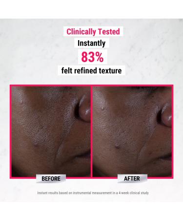 Discover Kiehl's Since 1851 Ultra Pure High-Potency 9.8% Glycolic Acid Serum 1.0 oz - Elevate Your Style Instantly! - Buy Online on GoSupps.com