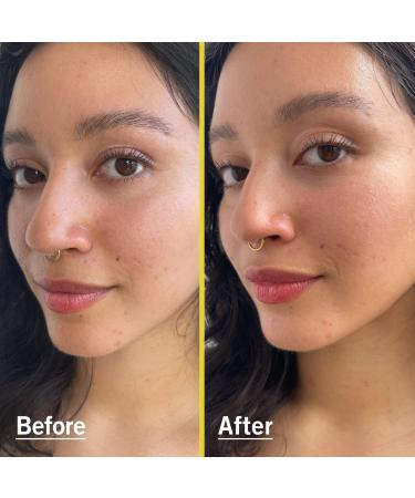 Discover First Aid Beauty Weightless Liquid Mineral Sunscreen With Zinc Oxide SPF 30 1.5 oz - Elevate Your Style Instantly! - Buy Online on GoSupps.com