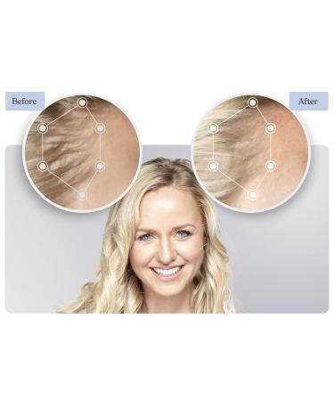 Keranique Hair and Scalp Supplements 60 ct - Discover Premium Quality Shop now! - Buy Online on GoSupps.com