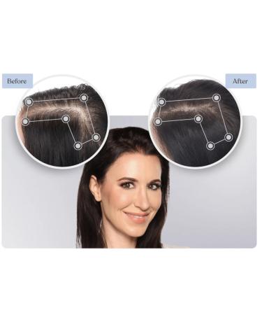 Discover Keranique Hair Regrowth Treatment For Women - 60 Day Supply - Elevate Your Style Instantly! - Buy Online on GoSupps.com