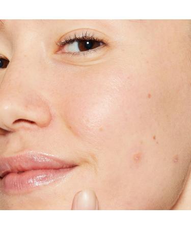 Dermalogica Deep Acne Invisible Liquid Patch 0.5 oz - Discover Premium Quality Shop now! - Buy Online on GoSupps.com