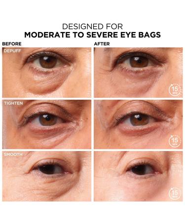 Discover IT Cosmetics Bye Bye Under Eye Bags Daytime Treatment - Elevate Your Style Instantly! - Buy Online on GoSupps.com