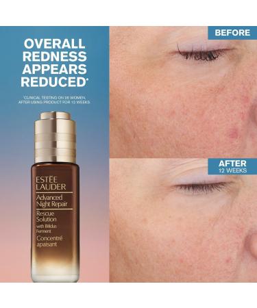 EstÃ©e Lauder Advanced Night Repair Rescue Solution Serum with 15% Bifidus Ferment 0.68 oz - Transform Your Style with the Best Innovation Today! - Buy Online on GoSupps.com