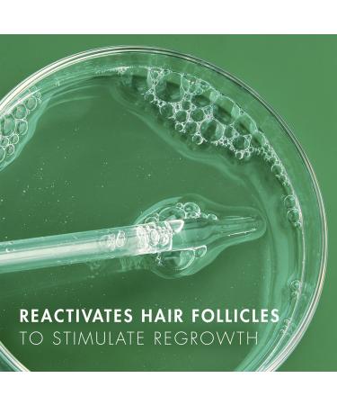 Discover Nexxus Minoxidil Topical Solution Treatment 2 oz - Elevate Your Style Instantly! - Buy Online on GoSupps.com