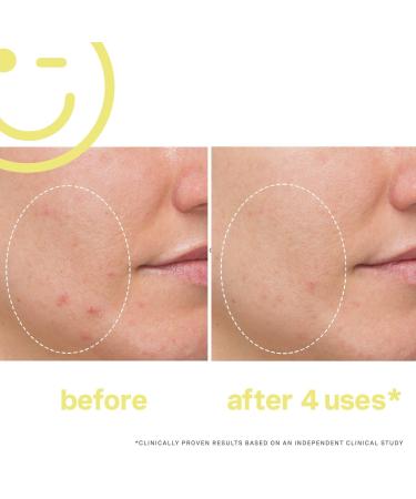 Kate Somerville Mega-C 30% Vitamin C Brightening Facial 2.0 oz - Transform Your Style with the Best Innovation Today! - Buy Online on GoSupps.com