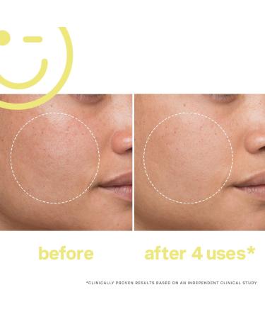 Kate Somerville Mega-C 30% Vitamin C Brightening Facial 2.0 oz - Transform Your Style with the Best Innovation Today! - Buy Online on GoSupps.com