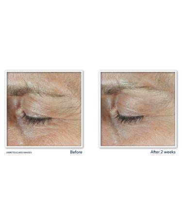 RoC Derm Correxion Dual Eye Cream with Advanced Retinol + Peptides 0.68 oz - Discover Premium Quality Shop now! - Buy Online on GoSupps.com