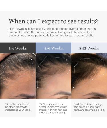Better Not Younger Superpower Thickening Hairpatches 14 pair - Transform Your Style with the Best Innovation Today! - Buy Online on GoSupps.com