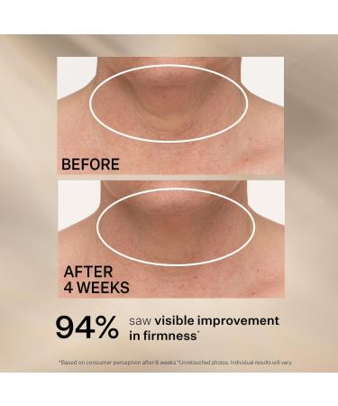 StriVectin Travel Size TL Advanced Tightening Neck Cream Plus 0.25 oz - Discover Premium Quality Shop now! - Buy Online on GoSupps.com