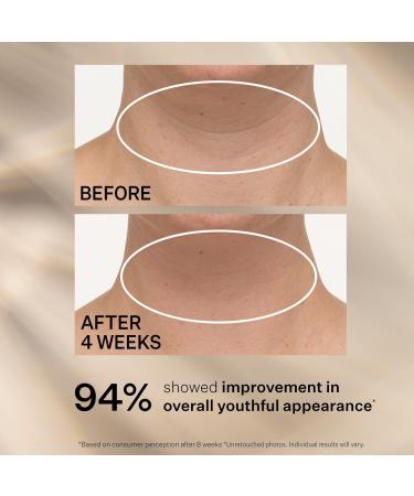 StriVectin Travel Size TL Advanced Tightening Neck Cream Plus 0.25 oz - Discover Premium Quality Shop now! - Buy Online on GoSupps.com