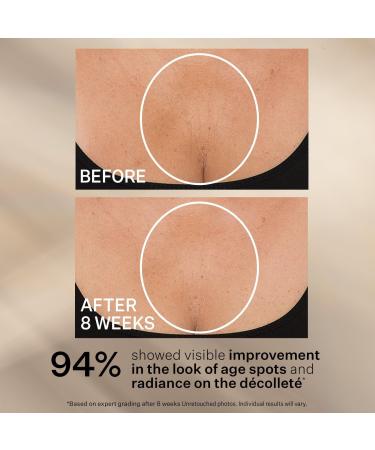 StriVectin Travel Size TL Advanced Tightening Neck Cream Plus 0.25 oz - Discover Premium Quality Shop now! - Buy Online on GoSupps.com