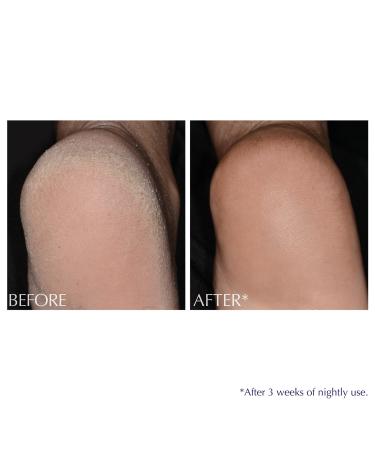 Exuviance Exfoliating & Conditioning Foot Balm 1.7 oz - Transform Your Style with the Best Innovation Today! - Buy Online on GoSupps.com